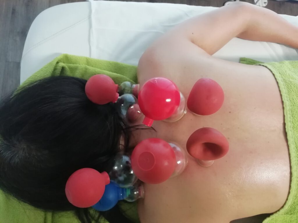 Schröpftherapie